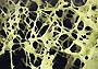RTEmagicC_osteo03_90px.jpg