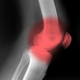 knie_80.jpg